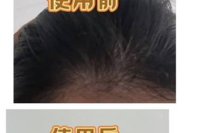 女人头发掉的厉害怎么办？有效预防和解决方法是什么？